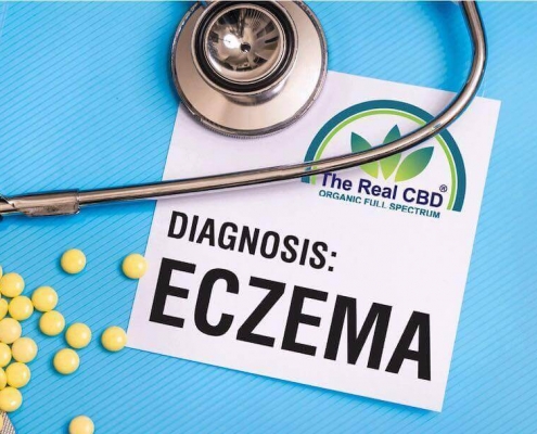 Eczema on a doctor's table with stethoscope and pills