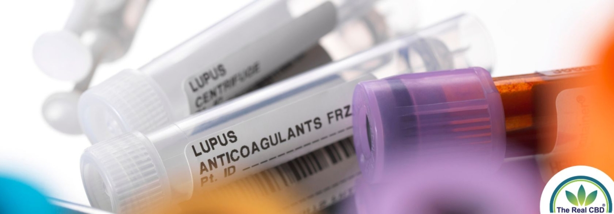 Lupus viral testing tubes