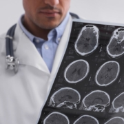 Doctors discussing brain scan