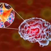 Brain with bacteria highlight