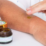Hand rubbing The Real CBD balm on the arm