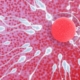 Sperm swimming towards an egg to fertilise