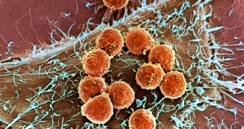 Cancer cells