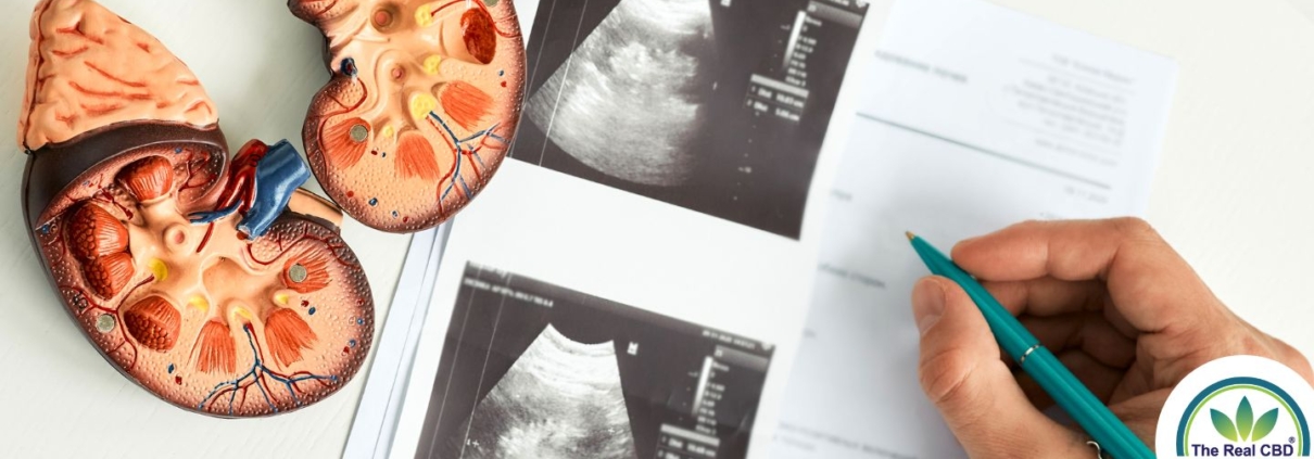 Scan pictures of kidneys with plastic kidney models on the side