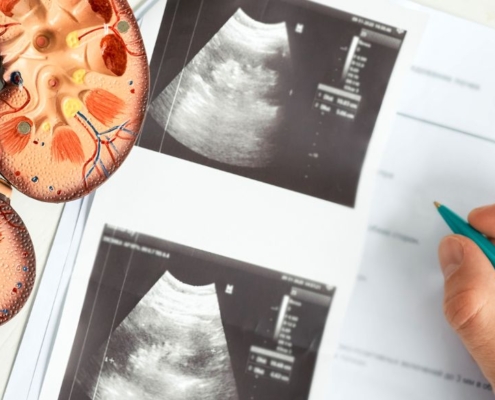 Scan pictures of kidneys with plastic kidney models on the side