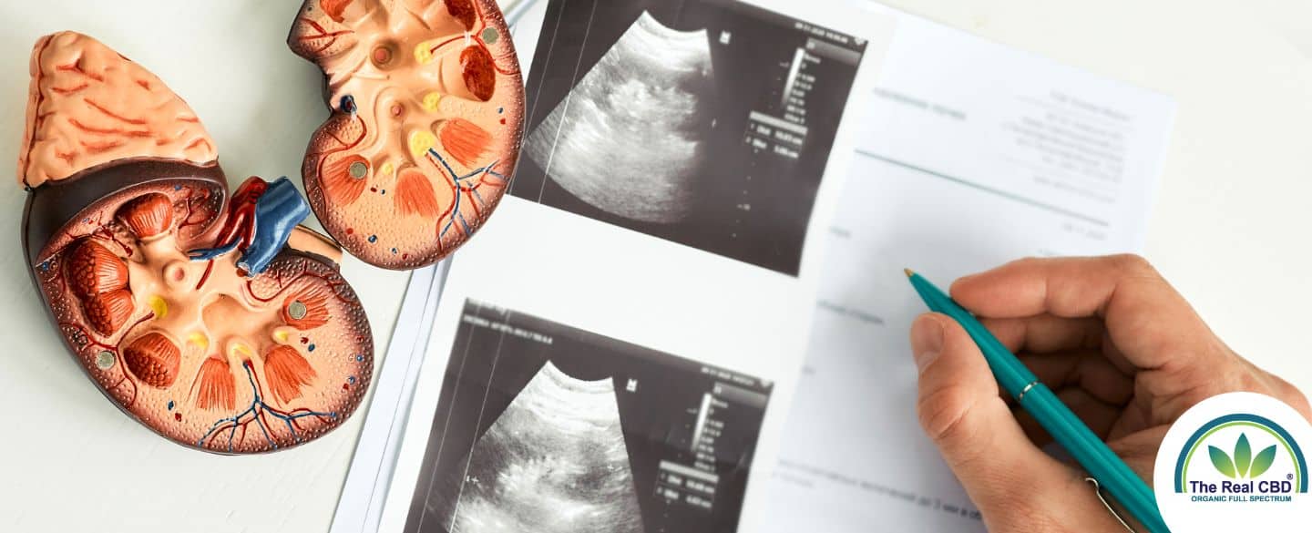 Scan pictures of kidneys with plastic kidney models on the side