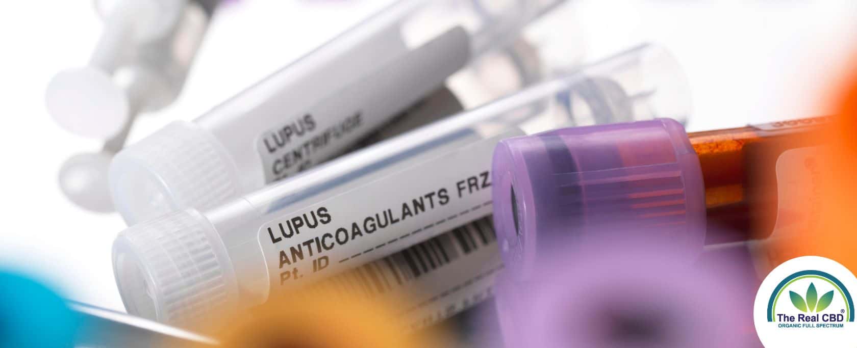 Lupus viral testing tubes