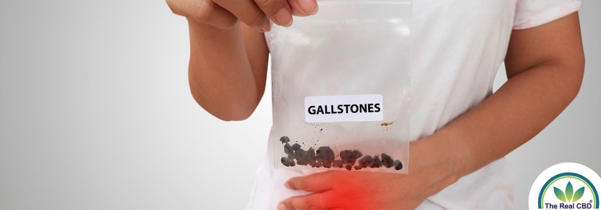 Person holding a bag of gallstones while holding his pelvis in pain