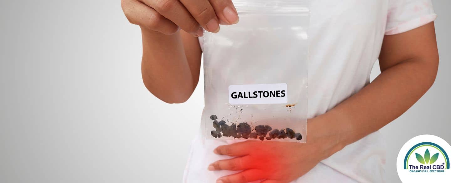 Person holding a bag of gallstones while holding his pelvis in pain