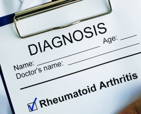 Arzt hält Klemmbrett mit rheumatoider Arthritis Diagnose auf