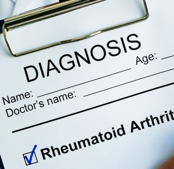 Arzt hält Klemmbrett mit rheumatoider Arthritis Diagnose auf