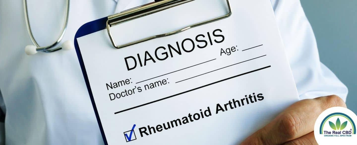 Arzt hält Klemmbrett mit rheumatoider Arthritis Diagnose auf