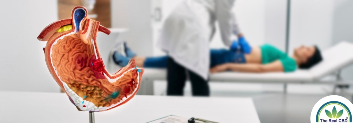 Stomach model on table with a doctor examining a woman on an examination bed