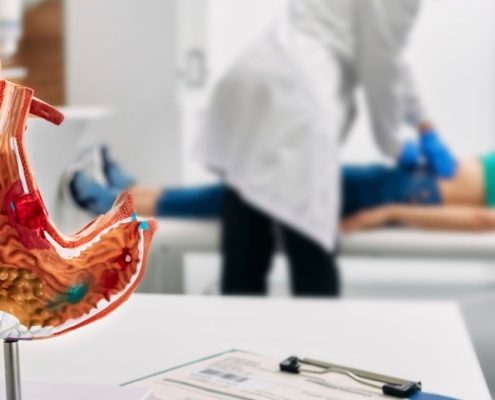 Stomach model on table with a doctor examining a woman on an examination bed