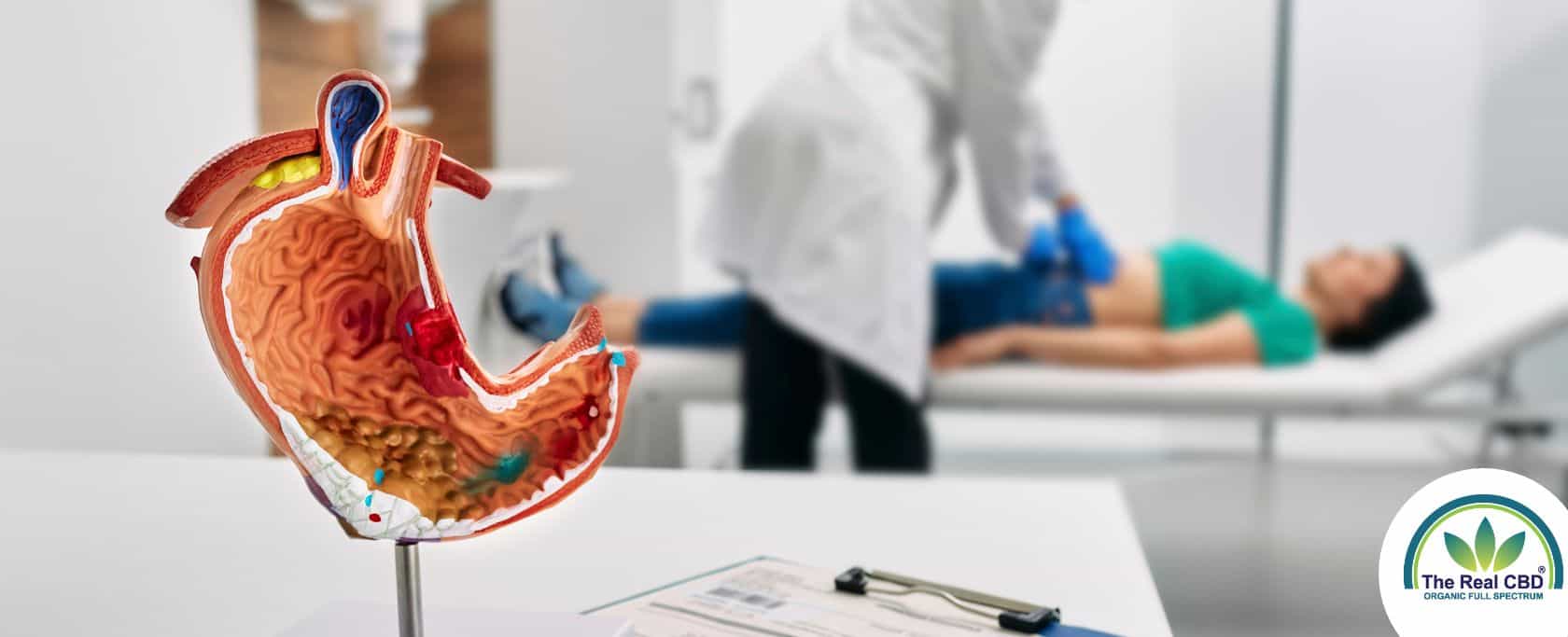 Stomach model on table with a doctor examining a woman on an examination bed