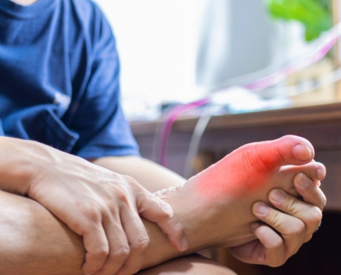 Man holding his foot with signs of Gout