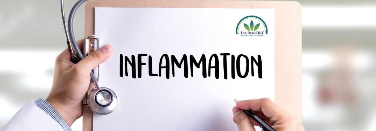 Arzt hält Klemmbrett mit der Aufschrift INFLAMMATION