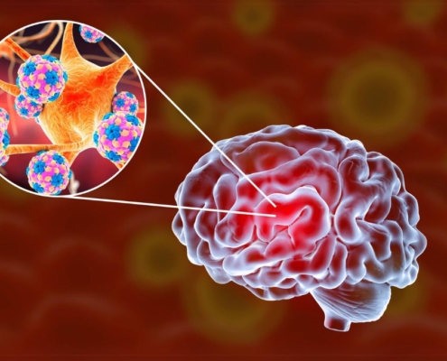 Cerveau avec mise en évidence des bactéries