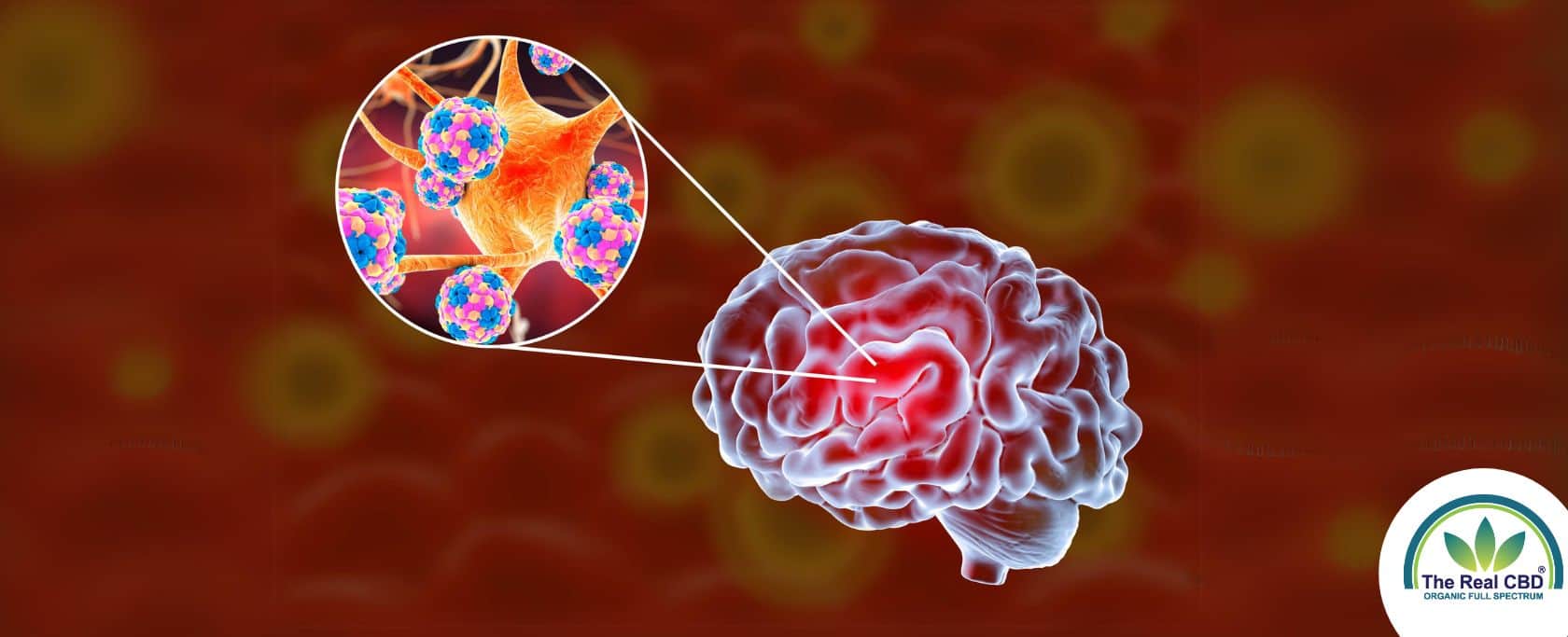 Cerveau avec mise en évidence des bactéries