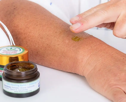 Hand, die The Real CBD Balsam auf den Arm reibt