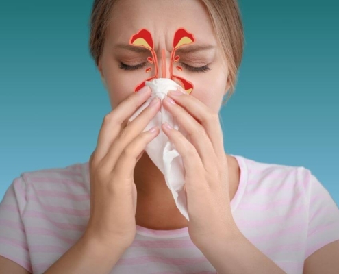 Woman blowing her nose with drawing illustrating her blocked sinuses