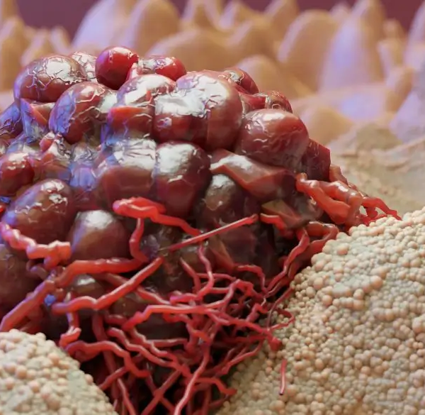 Close-up of cancer red cell