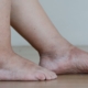 Jambes et pieds gonflés