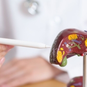 Doctor explaining hepatitis to a patient with a plastic liver model